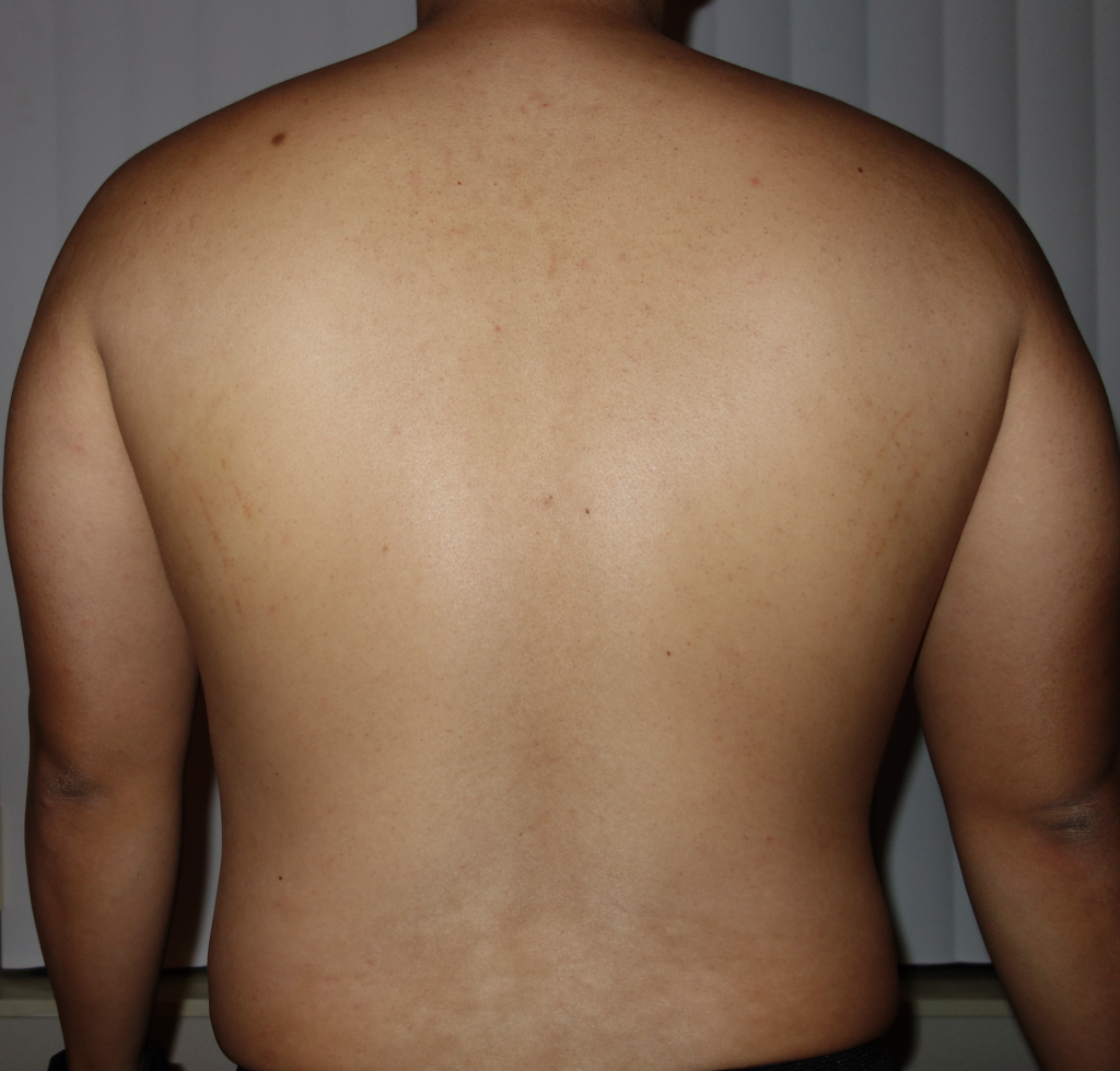 PP 10.15 Back
