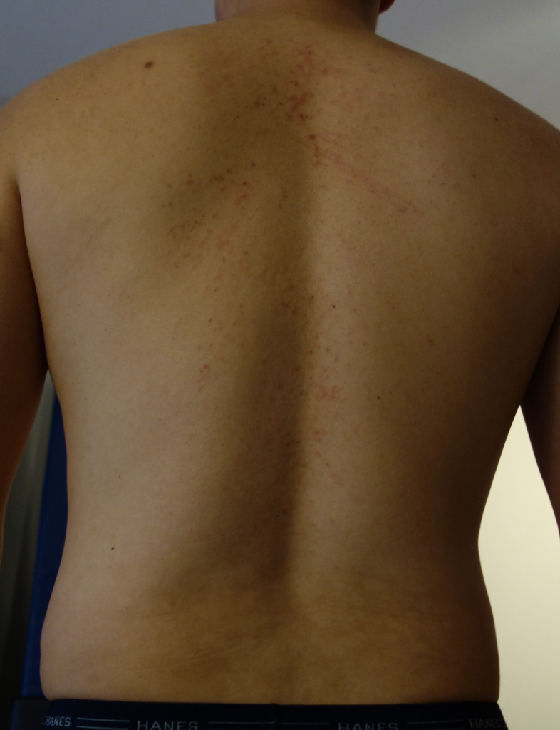 PP 11.1 Back