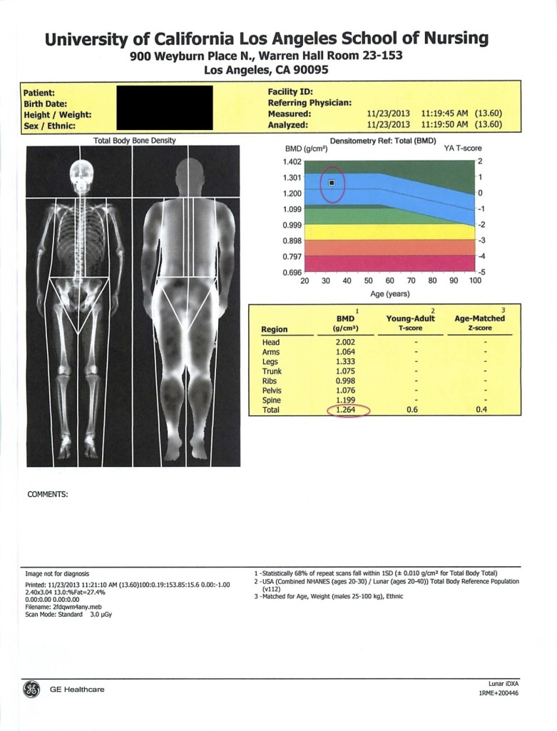 Dexa2